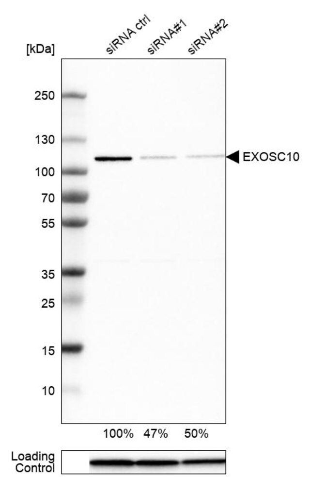 Anti-EXOSC10 antibody produced in rabbit