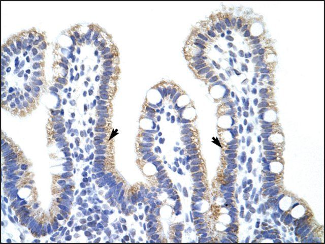 Anti-EXOSC10 antibody produced in rabbit