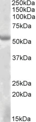 Anti-EYA1 antibody produced in goat