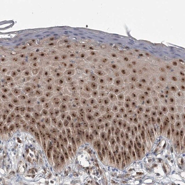 Anti-EXOSC1 antibody produced in rabbit