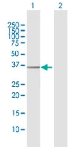 Anti-EXTL2 antibody produced in rabbit