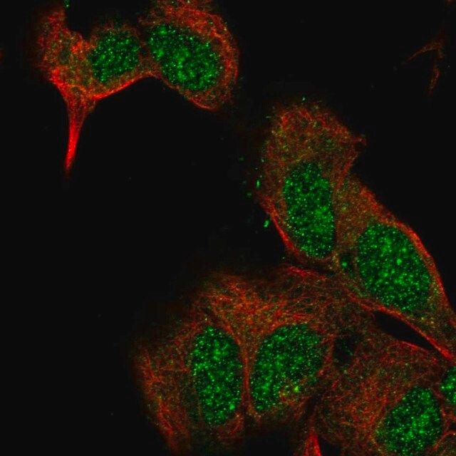 Anti-EXTL2 antibody produced in rabbit