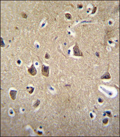 ANTI-FADS6 (C-TERM) antibody produced in rabbit