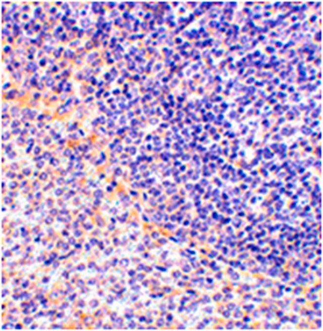 Anti-FAF1 Antibody