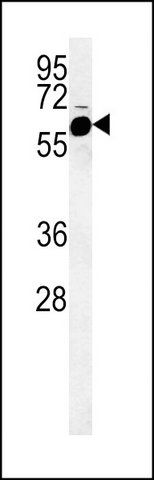 ANTI-FADS2 (CENTER) antibody produced in rabbit