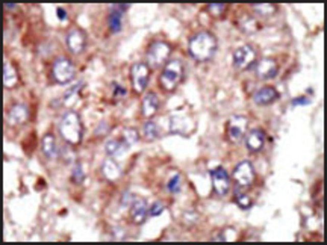 Anti-FACL6 (N-term) antibody produced in rabbit