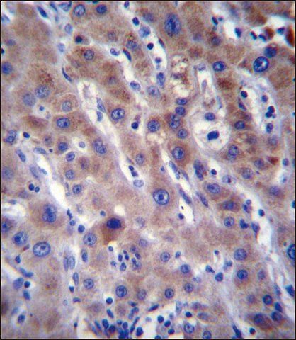 ANTI-FADS2 (N-TERM) antibody produced in rabbit