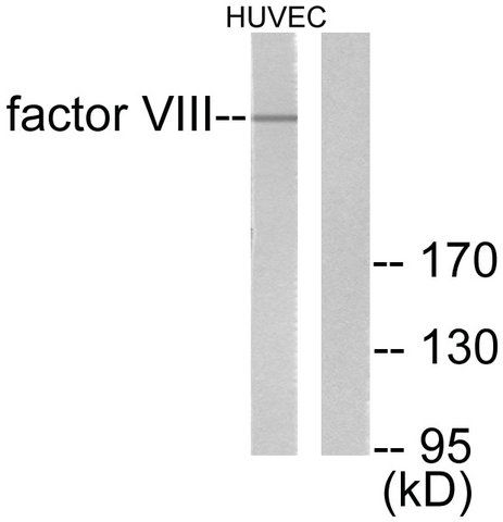 Anti-Factor VIII antibody produced in rabbit