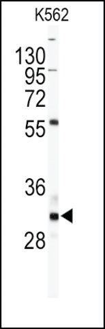 Anti-FACL6 (center) antibody produced in rabbit