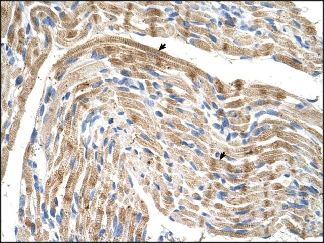 Anti-FADS1 antibody produced in rabbit