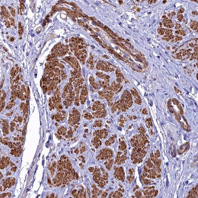 Anti-FADS3 antibody produced in rabbit