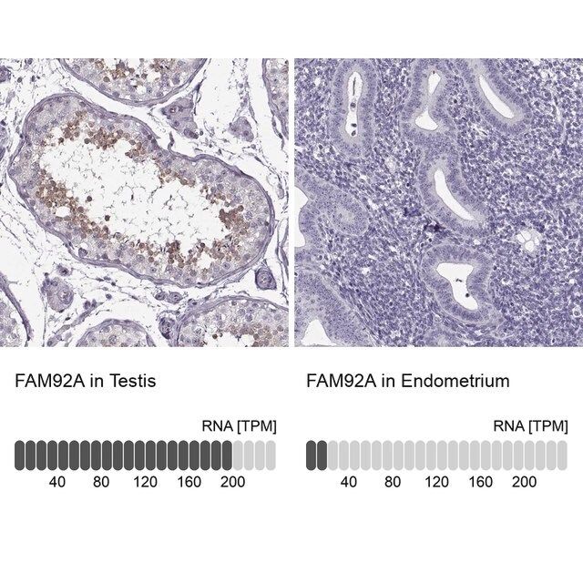 Anti-FAM92A