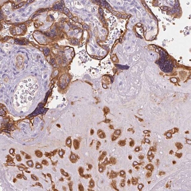 Anti-FAM149A antibody produced in rabbit