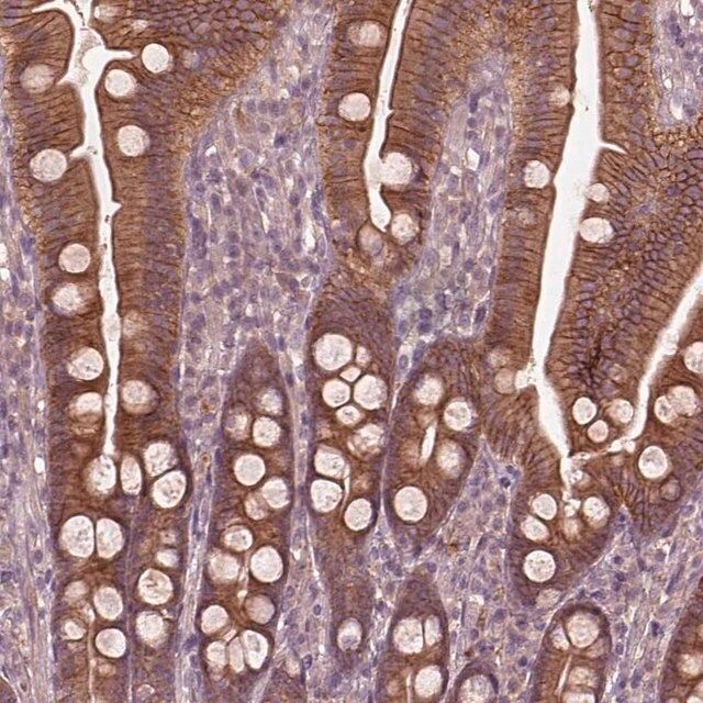 Anti-FAM234A antibody produced in rabbit