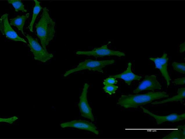 Anti-FAM60A antibody produced in mouse