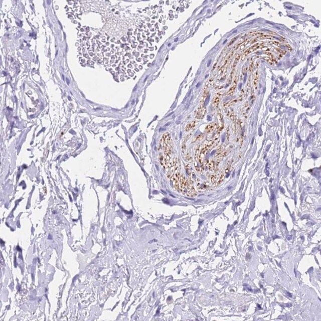 Anti-FAM72A antibody produced in rabbit