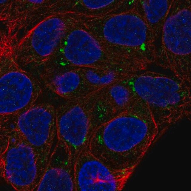 Anti-FAM149A antibody produced in rabbit