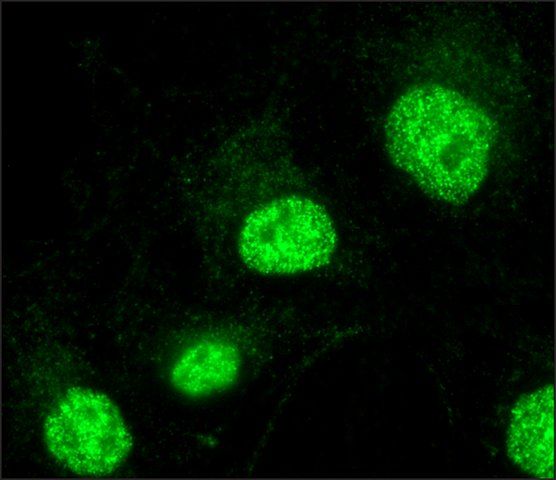 Anti-FAM48A /P38IP antibody produced in rabbit