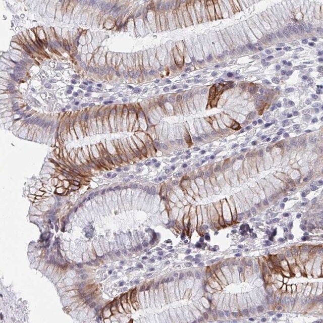 Anti-FAM156A antibody produced in rabbit