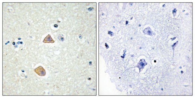 Anti-EFNA5 antibody produced in rabbit