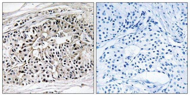 Anti-EHHADH antibody produced in rabbit