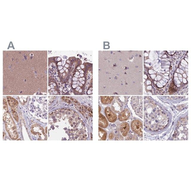 Anti-DUS2 antibody produced in rabbit