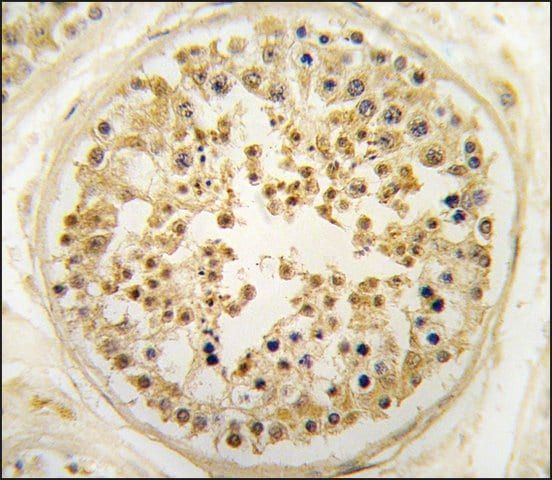 Anti-EARS2 (C-term) antibody produced in rabbit