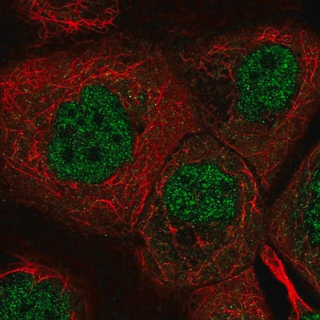 Anti-DYRK2 antibody produced in rabbit