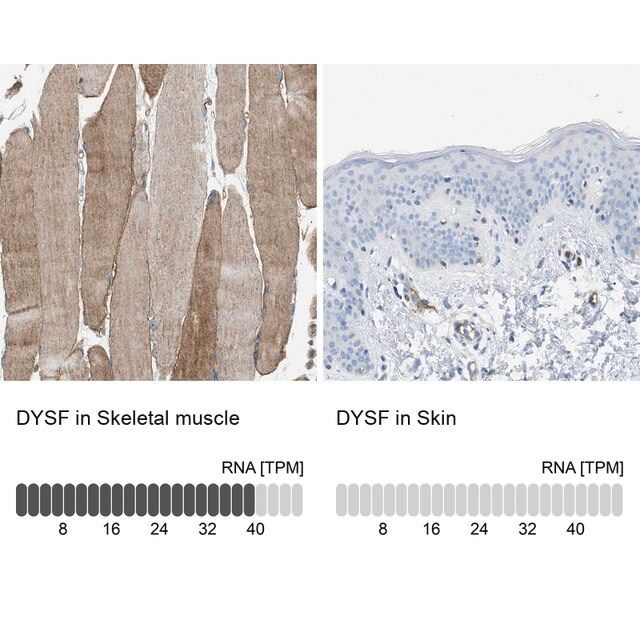 Anti-DYSF antibody produced in rabbit