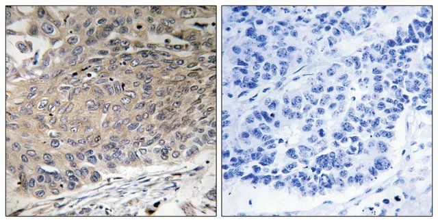 Anti-DYNLL2 antibody produced in rabbit