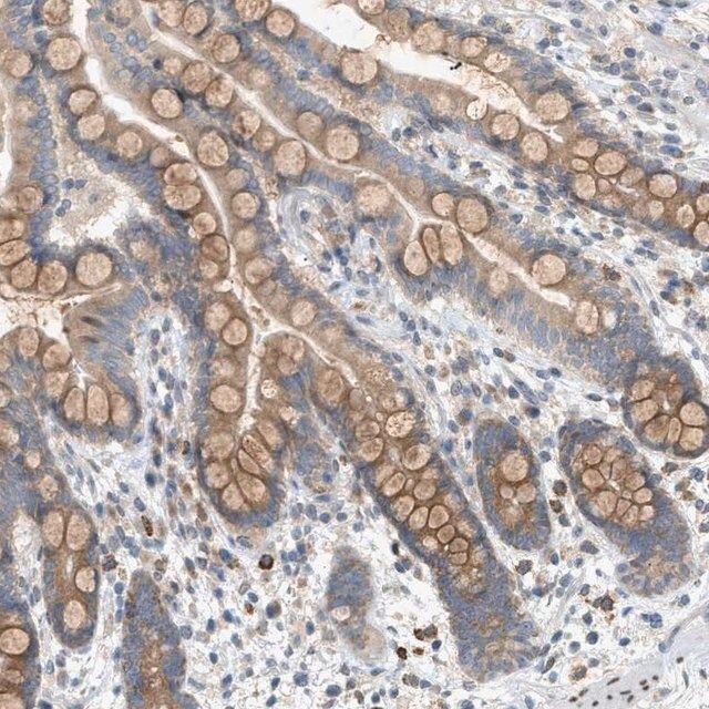 Anti-DYRK1A antibody produced in rabbit