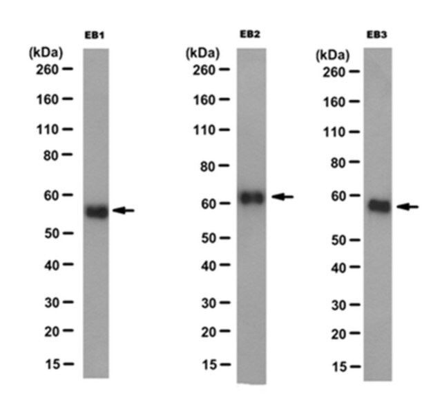 Anti-EB1, EB2 and EB3 Antibody, clone KT65