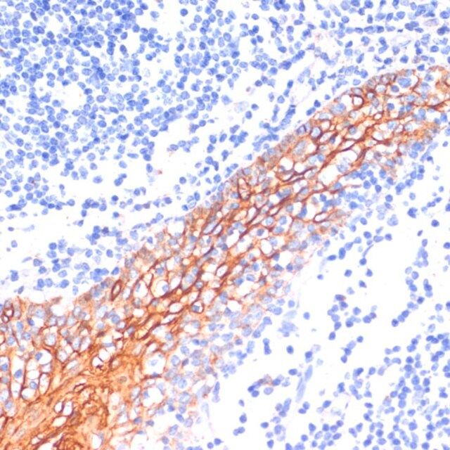 Anti-E-cadherin antibody produced in rabbit