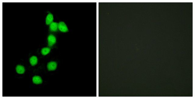 Anti-DYR1A antibody produced in rabbit