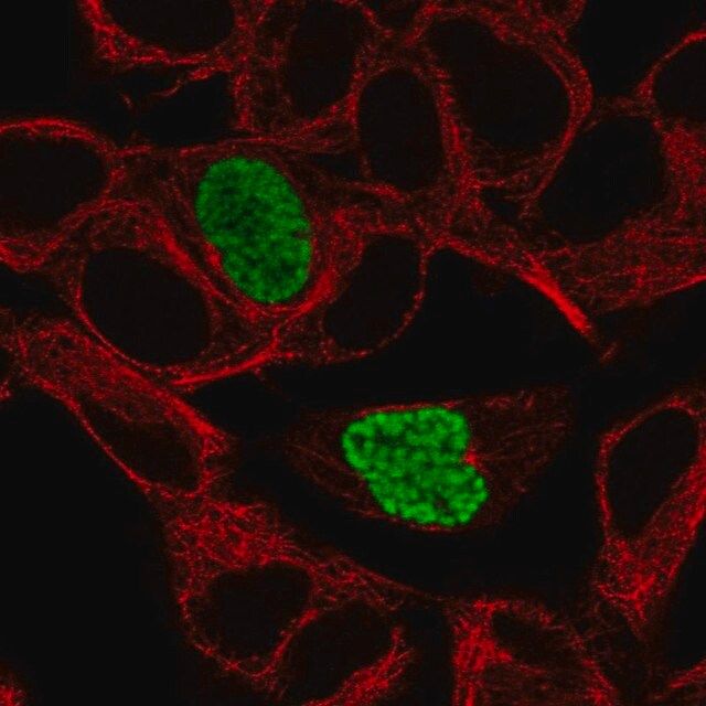 Anti-DYRK1B antibody produced in rabbit