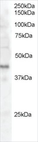 Anti-Dysadherin antibody produced in goat