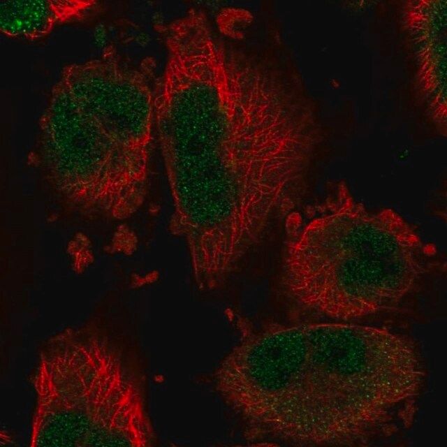 Anti-DYNLT1 antibody produced in rabbit