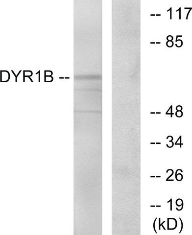 Anti-DYR1B antibody produced in rabbit