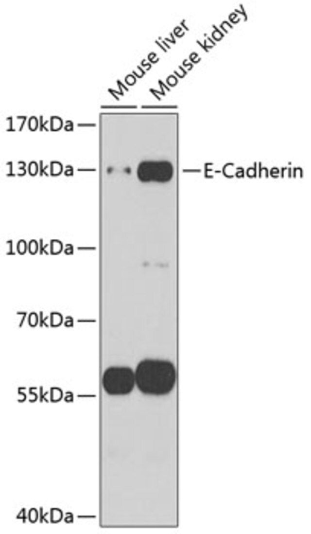 Anti-E-cadherin antibody produced in rabbit