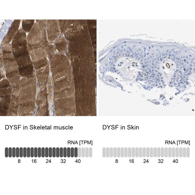 Anti-DYSF antibody produced in rabbit