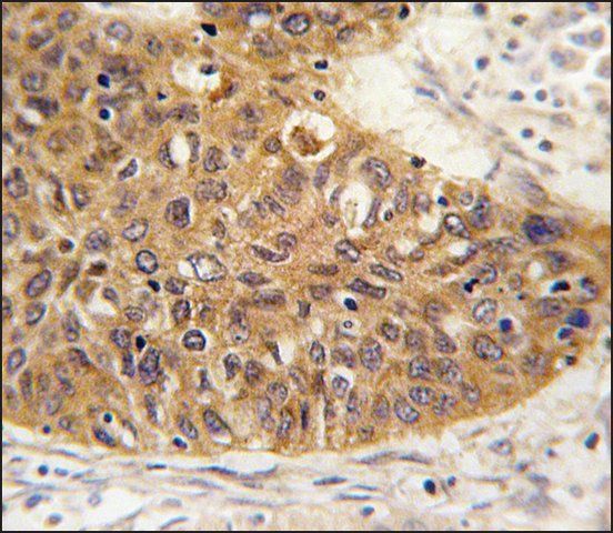 Anti-EARS2 (center) antibody produced in rabbit