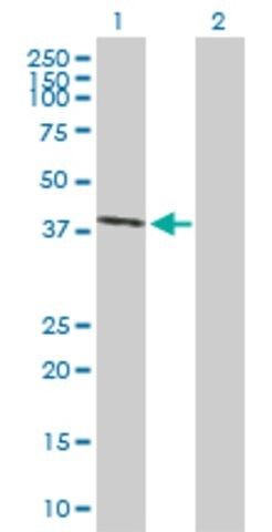 Anti-EAF2 antibody produced in mouse