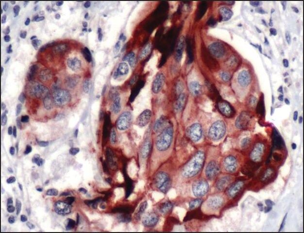 Anti-E-Cadherin antibody, Rabbit monoclonal