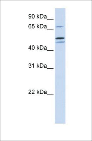 Anti-EARS2 antibody produced in rabbit