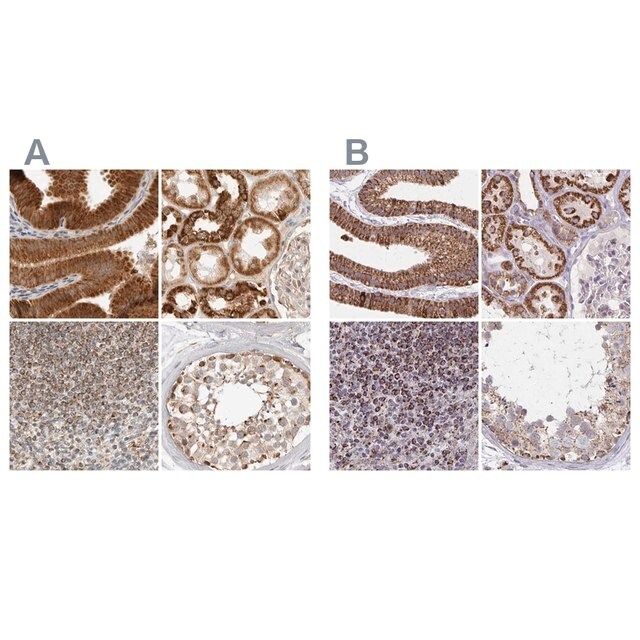 Anti-DYRK4 antibody produced in rabbit