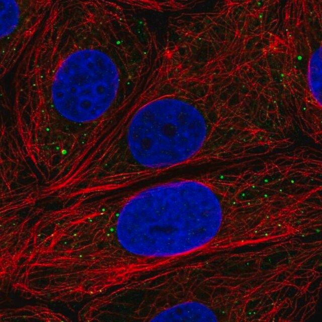 Anti-EDC3 antibody produced in rabbit