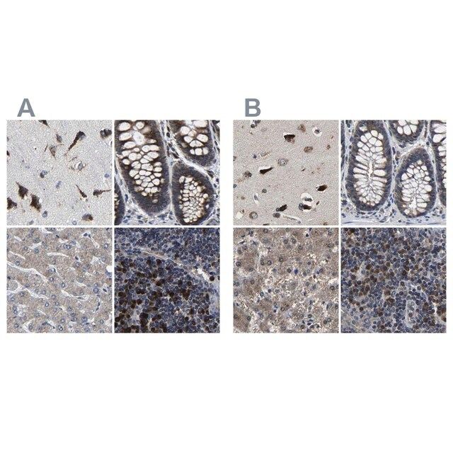 Anti-EBAG9 antibody produced in rabbit