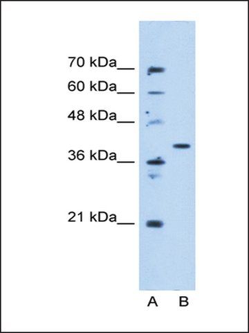 Anti-ECHDC3 antibody produced in rabbit