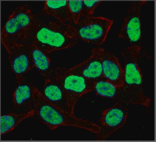 Anti-E3 ubiquitin-protein ligase UHRF1 Antibody, clone 7C8