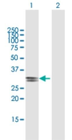 Anti-ECHDC2 antibody produced in mouse